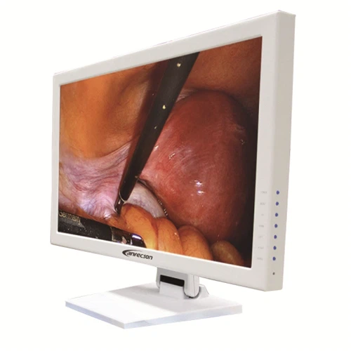 15 dyuymli rangli endoskop tibbiy monitor